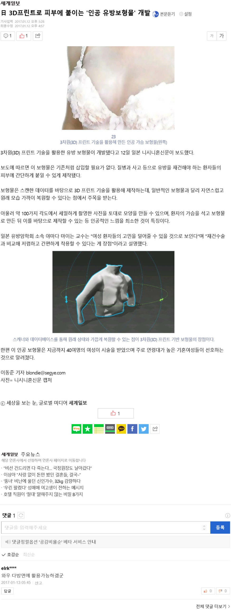 韓国の「世界日報」というサイトで人工乳房が紹介されました。
